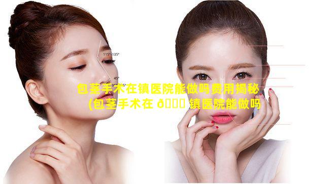 包茎手术在镇医院能做吗费用揭秘(包茎手术在 🐘 镇医院能做吗费用揭秘多少钱)